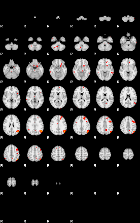 Patients 29182 34