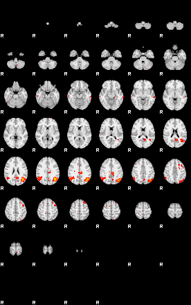 Patients 29185 122