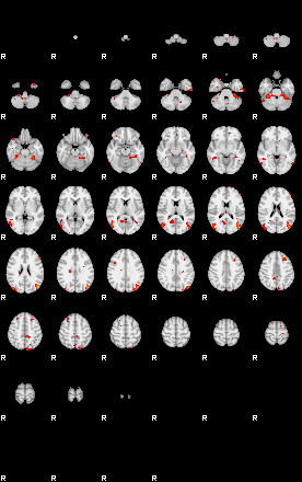 Patients 29186 125