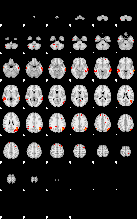 Patients 29187 129