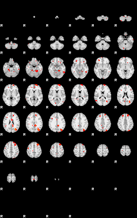 Patients 29188 198