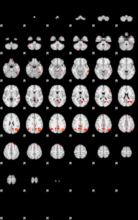 Patients 29192 134