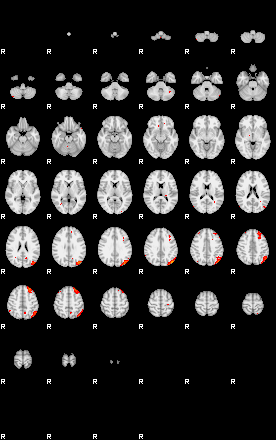 Patients 29193 131