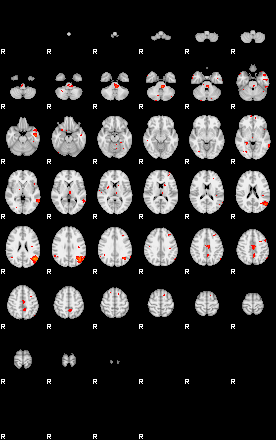 Patients 29205 134