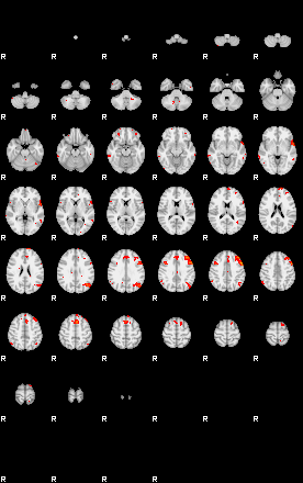 Patients 29212 98