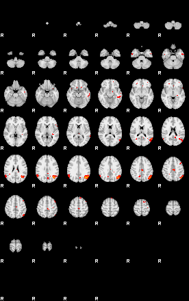 Patients 29216 120