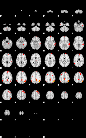 Patients 29290 113