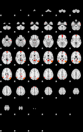 Patients 29291 120