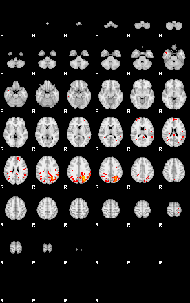 Patients 29391 150