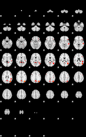 Patients 29410 12