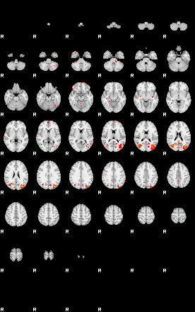 Patients 29449 120