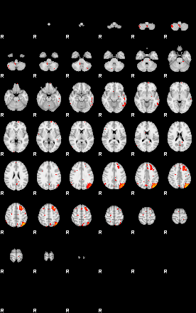 Patients 29511 31