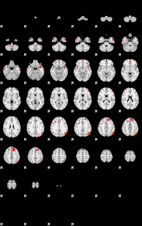 Patients 29515 14