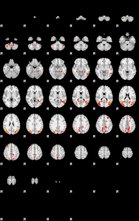 Patients 29545 12