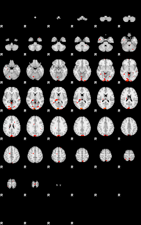 Patients 29155 7