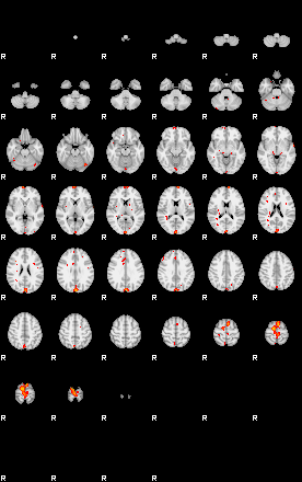 Patients 29163 122