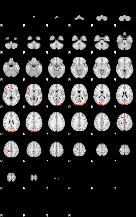 Patients 29013 130