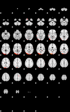 Patients 29180 122