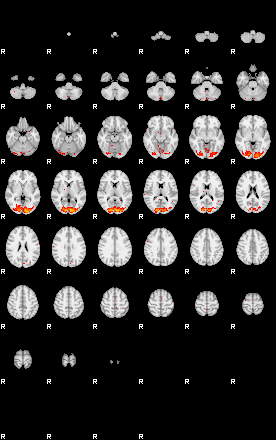 Patients 29503 150