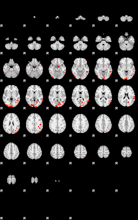 Patients 30175 8