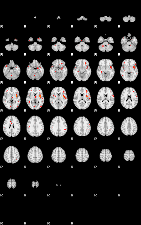 Patients 28789 96