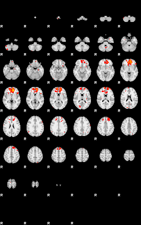 Patients 28905 123