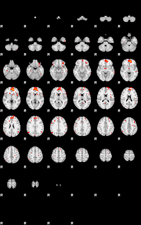 Patients 29013 135