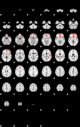 Patients 29017 21