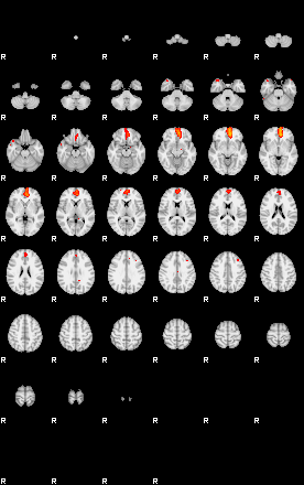 Patients 29060 116