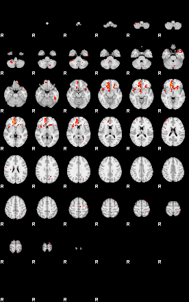 Patients 29214 150