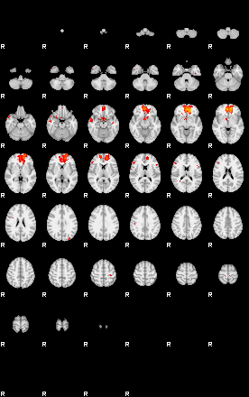 Patients 29215 197