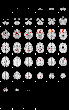 Patients 29216 138