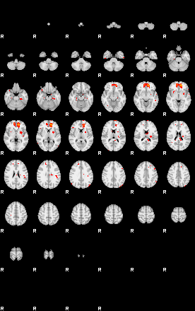 Patients 29283 199