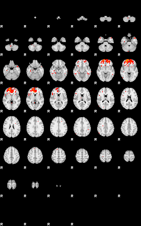 Patients 29292 123