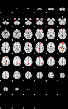 Patients 29612 23