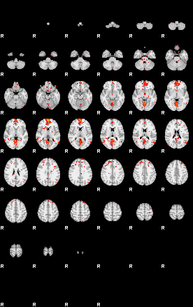 Patients 29613 143