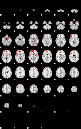 Patients 29623 126