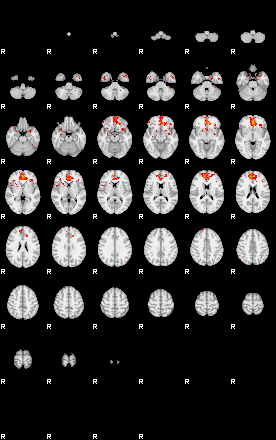 Patients 29657 131