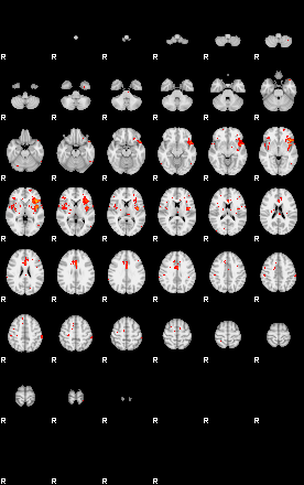 Patients 28924 92