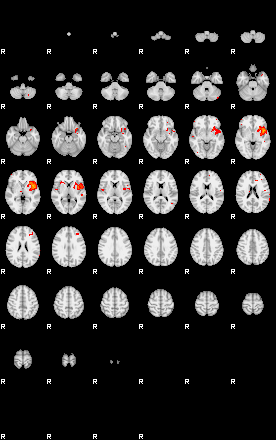 Patients 29097 78