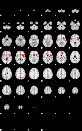 Patients 29515 171