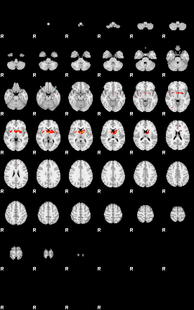 Patients 29514 56