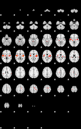 Patients 28761 87