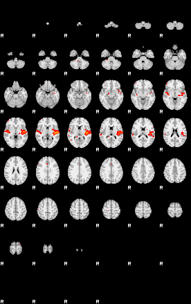 Patients 29200 87