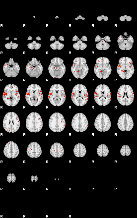 Patients 29281 75