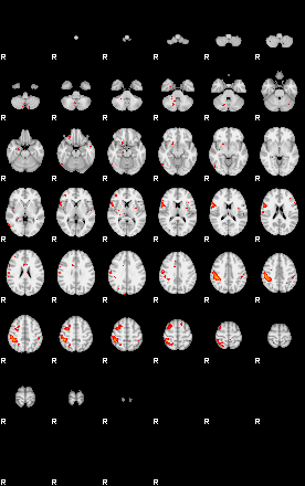 Patients 29029 200