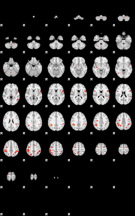 Patients 29184 137