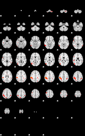 Patients 29516 15