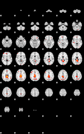 Patients 29055 200