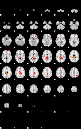 Patients 29170 173